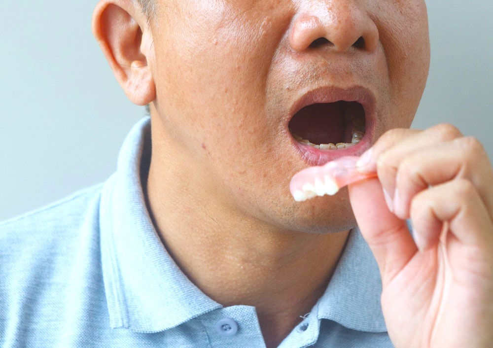 入れ歯とは