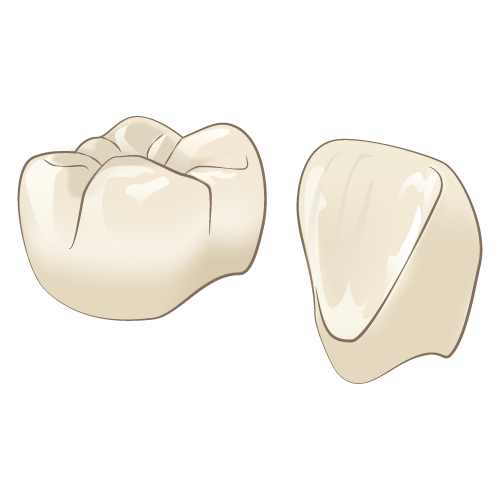 硬質レジンジャケット冠