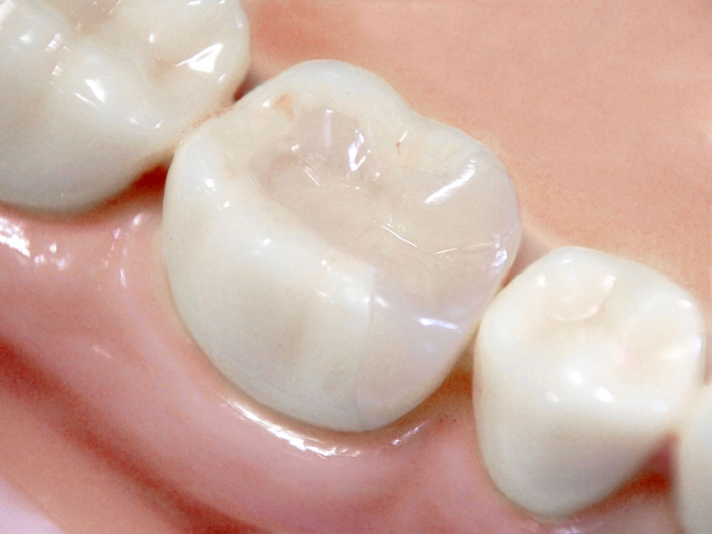 メタルフリーの取り組み